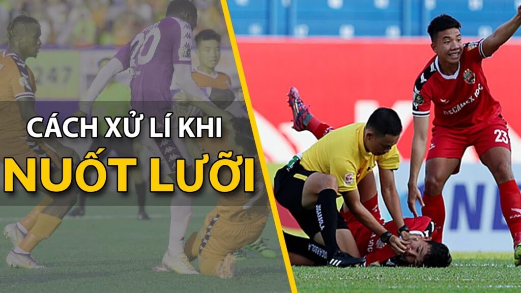 Cách xử lý hiện tượng nuốt lưỡi 